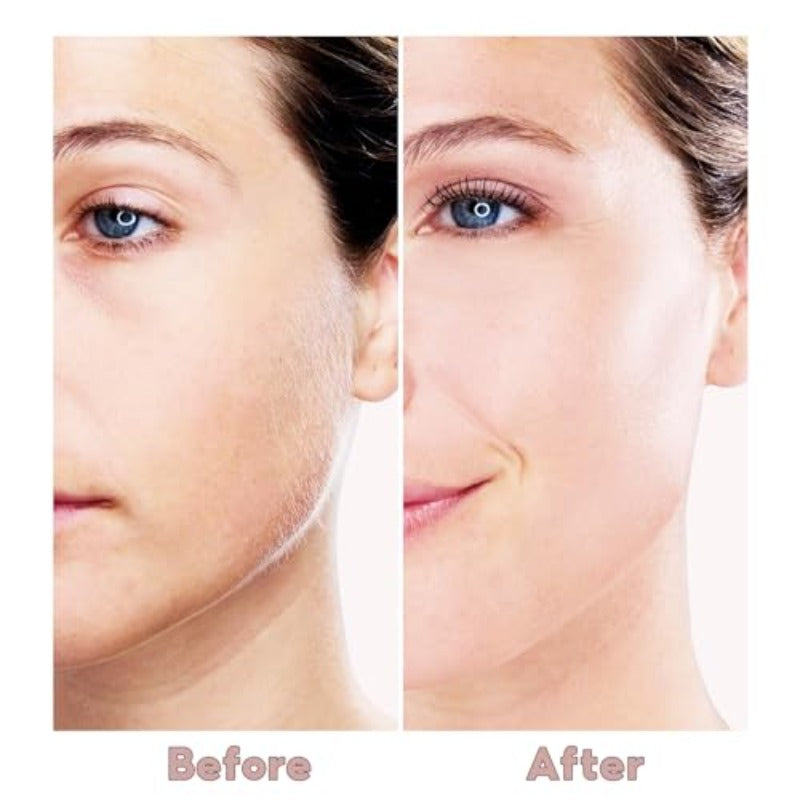 Facial Hair Remover for Women White Color with 6pcs Pack, Hair Removal Tool, Facial Hair Removal, Portable Grooming, Sleek Design, Easy to Use, Highquality Material, Smooth Finish, Beauty Device, Facial Epilator